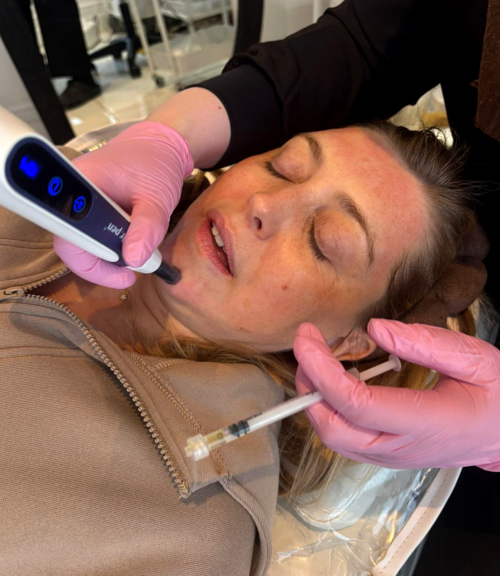 Plasma Pen treatment at A&A Medical Aesthetics